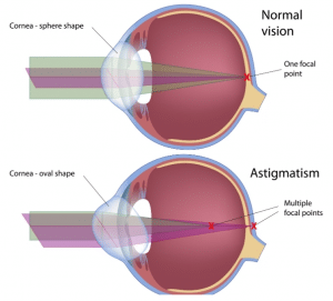 [5 Tips] How To Fix Red Dot Astigmatism Problems